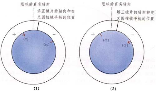 交叉圆柱镜技术